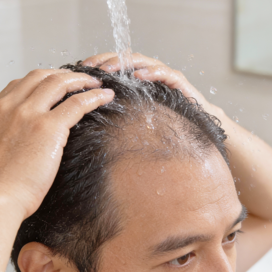 Rinse it with lukewarm water and dry