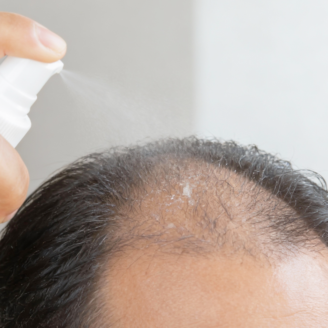 Apply on hair roots and massage gently 2-3 minutes