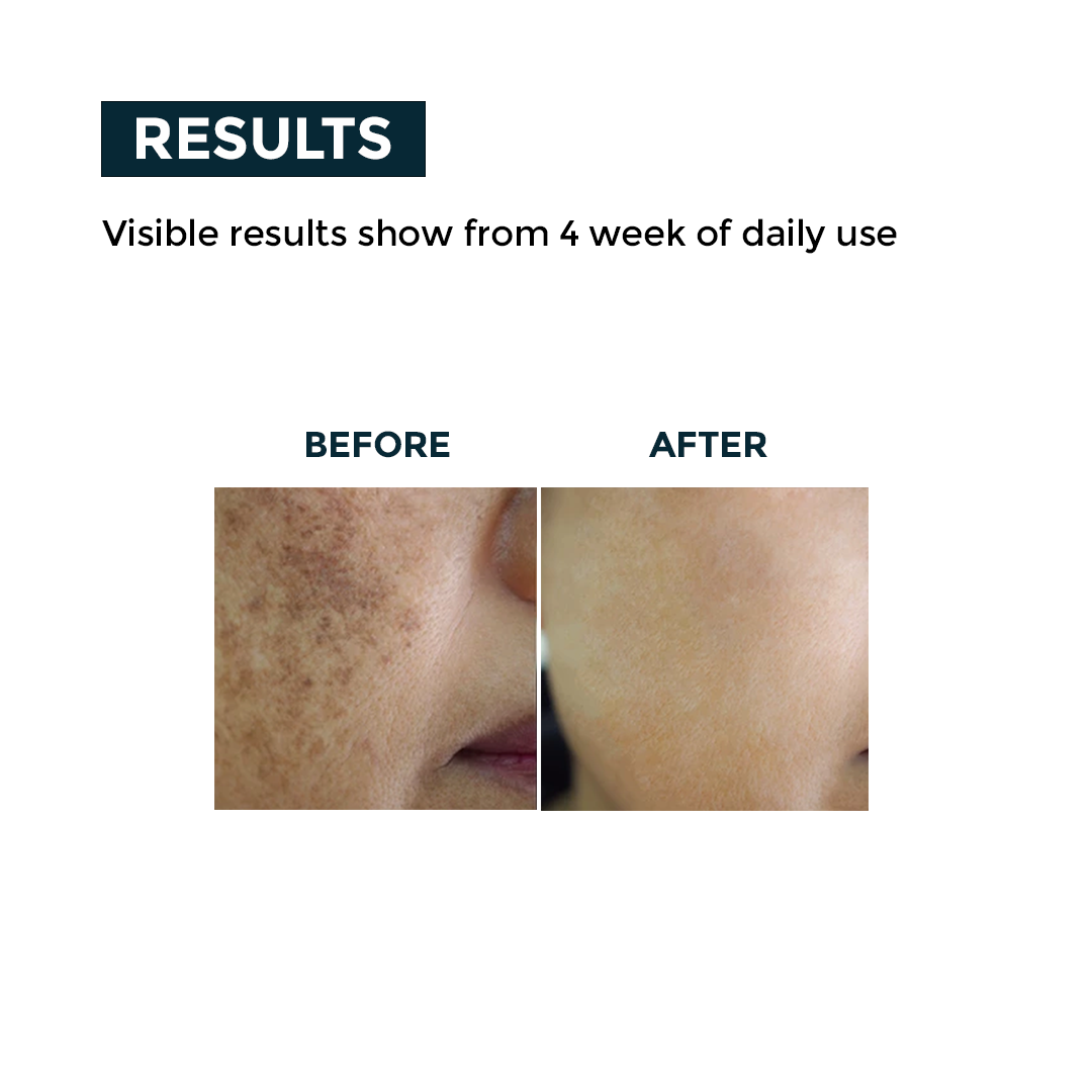 Nerbon Depigmentation Face Wash