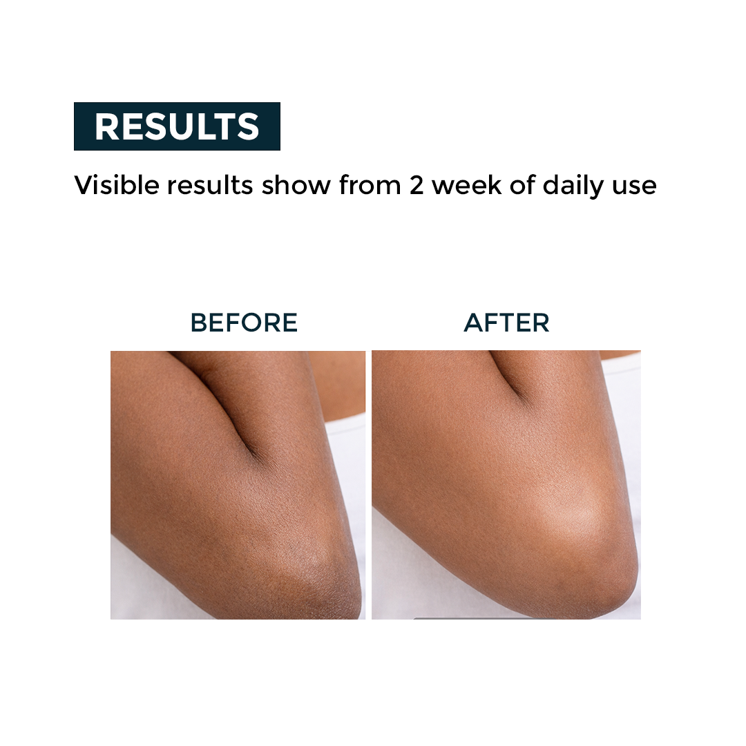 Nerbon Detan Body Lotion