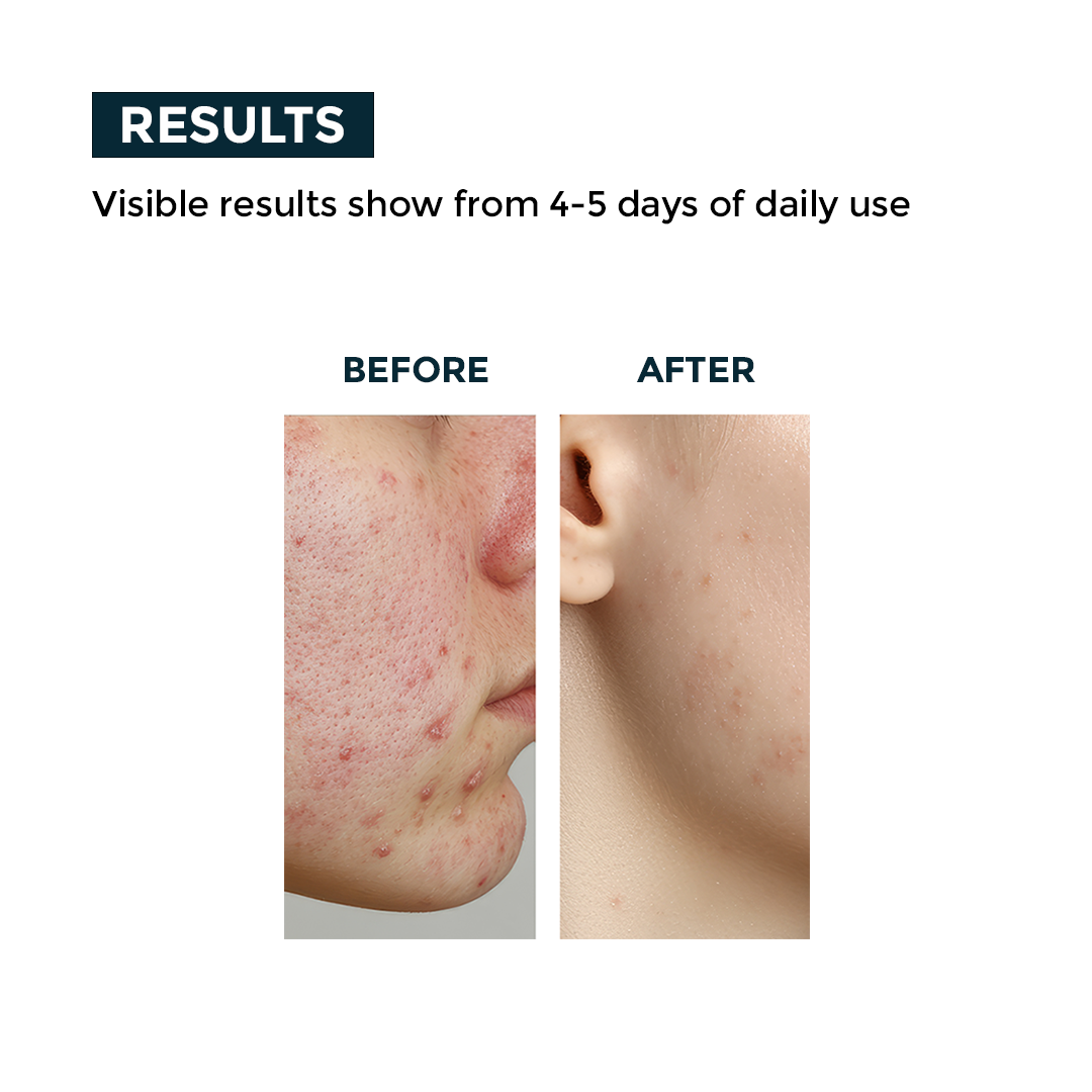 Nerbon Neem & Tulsi Face Wash