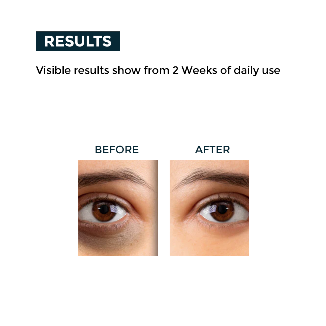 Nerbon Skin Repair Gel
