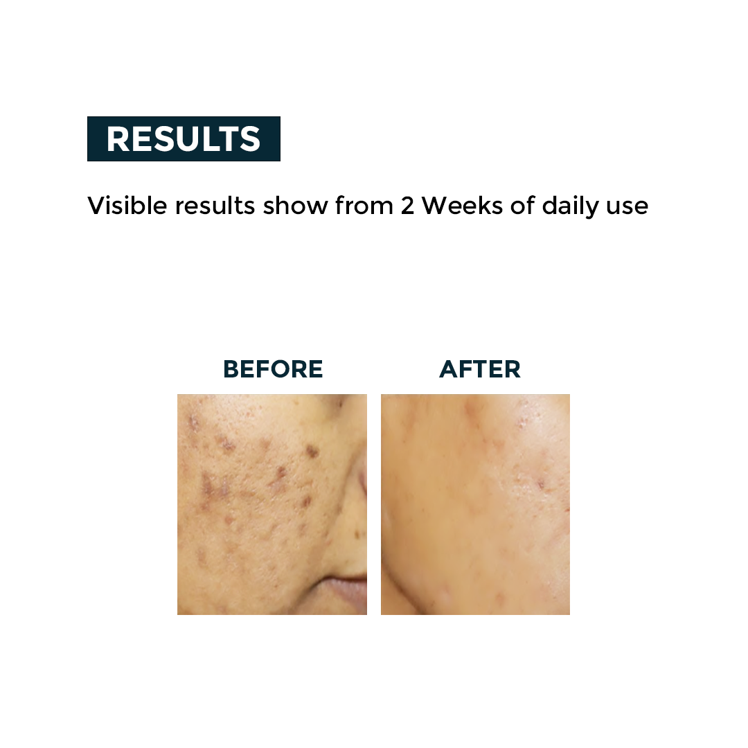 Nerbon Vitamin C Face Serum