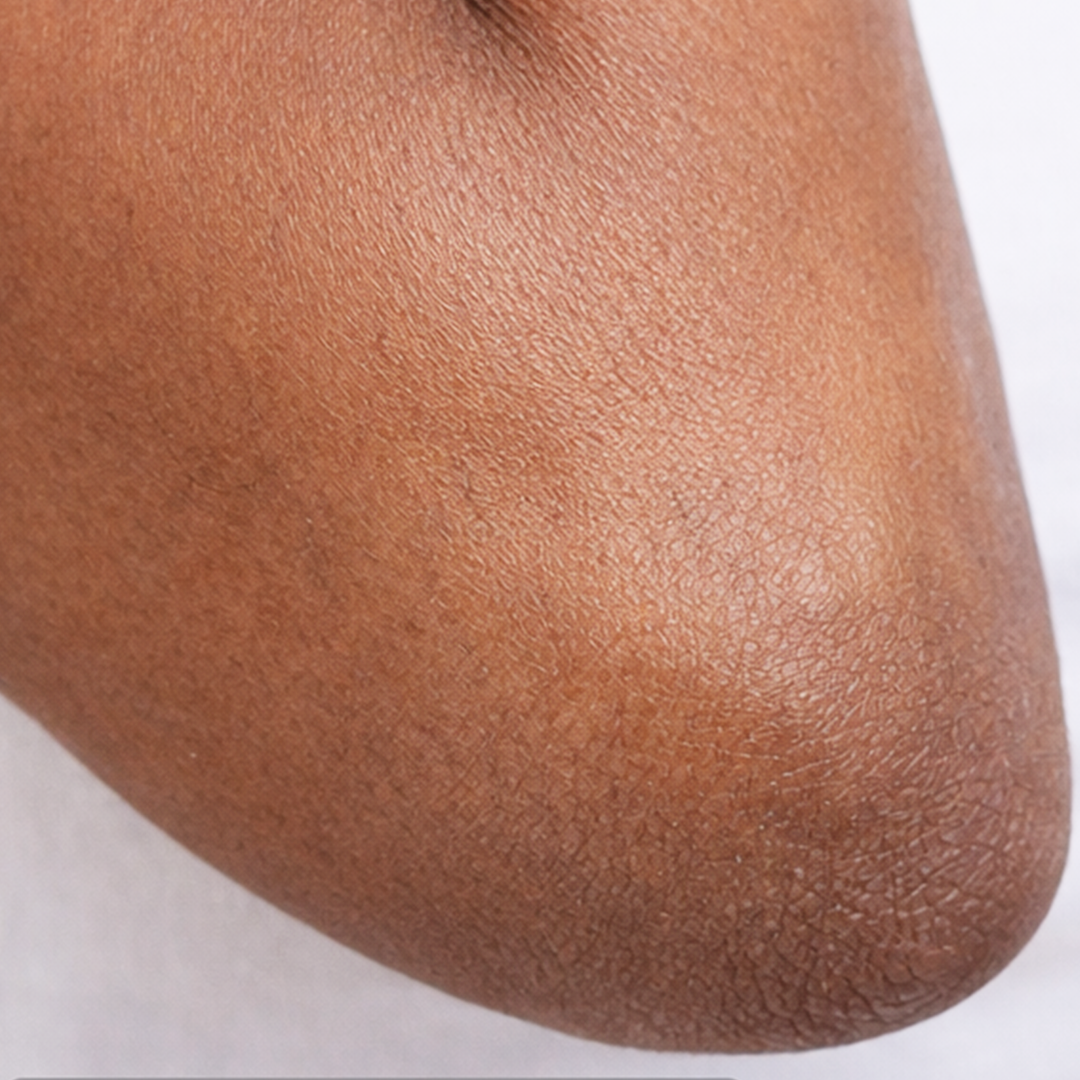 Dark elbow and knee