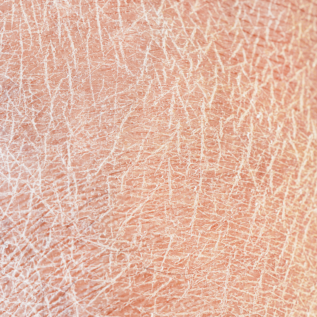 For dry skin