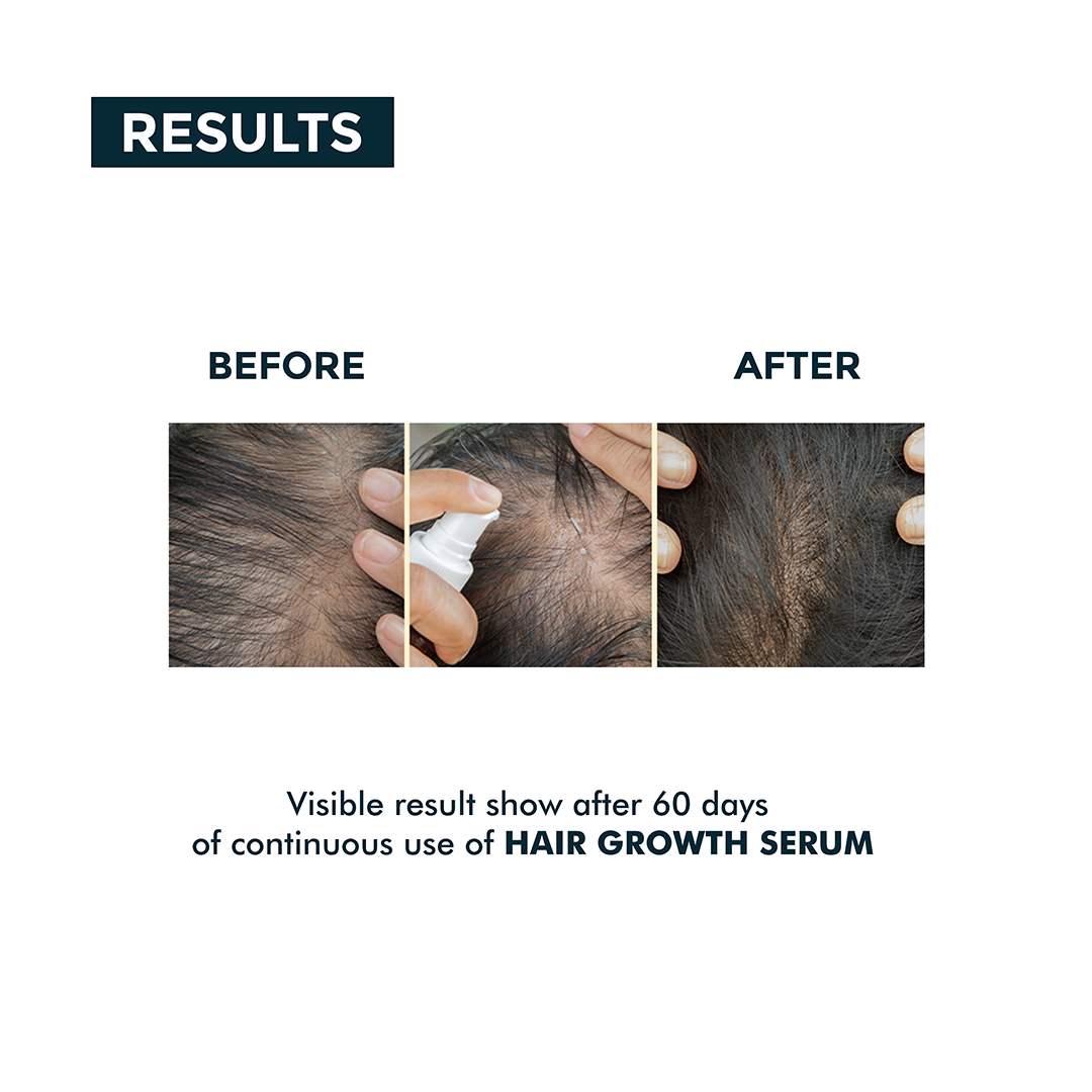 Nerbon Hair Growth Serum